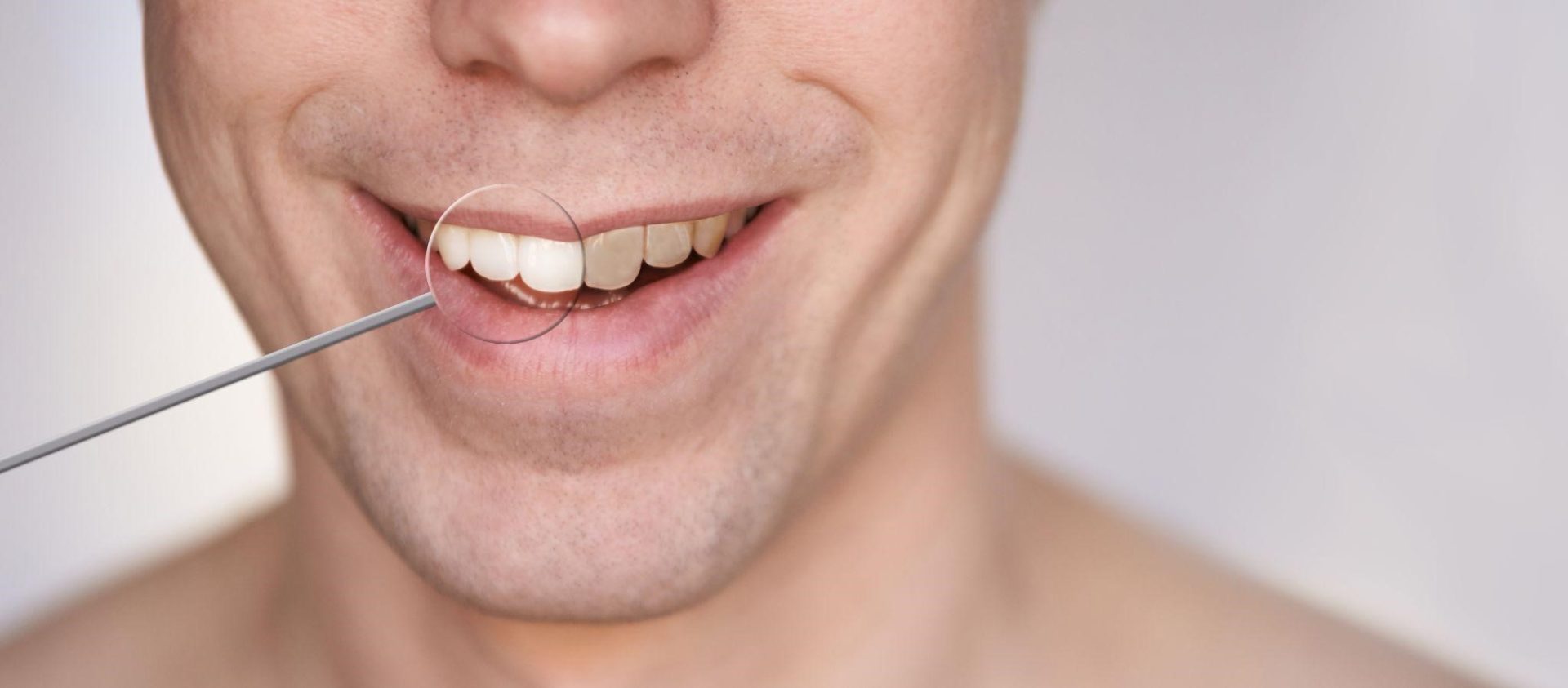 The Secret Behind Teeth Whitening