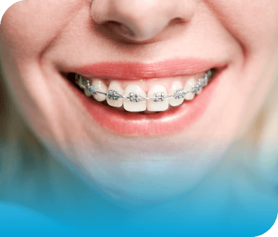 Corrective-Dentistry