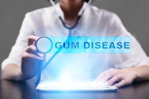 Gum Disease in pregnency